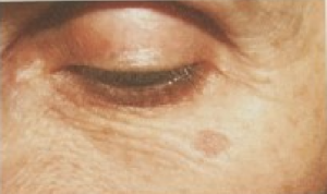 Skin texture and appearance
